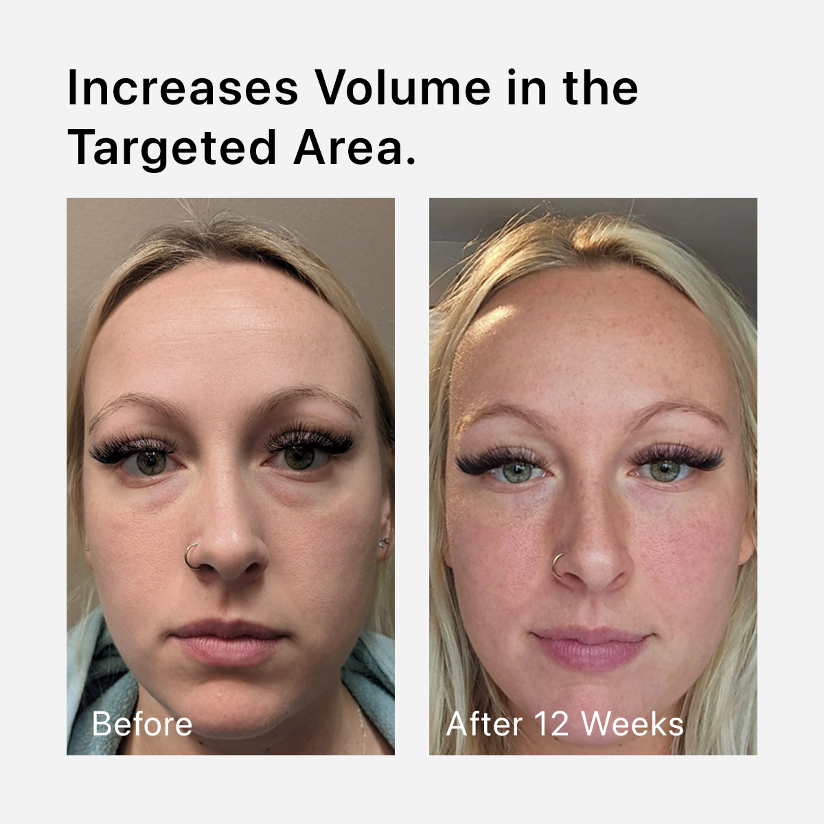 Volufiline 100%